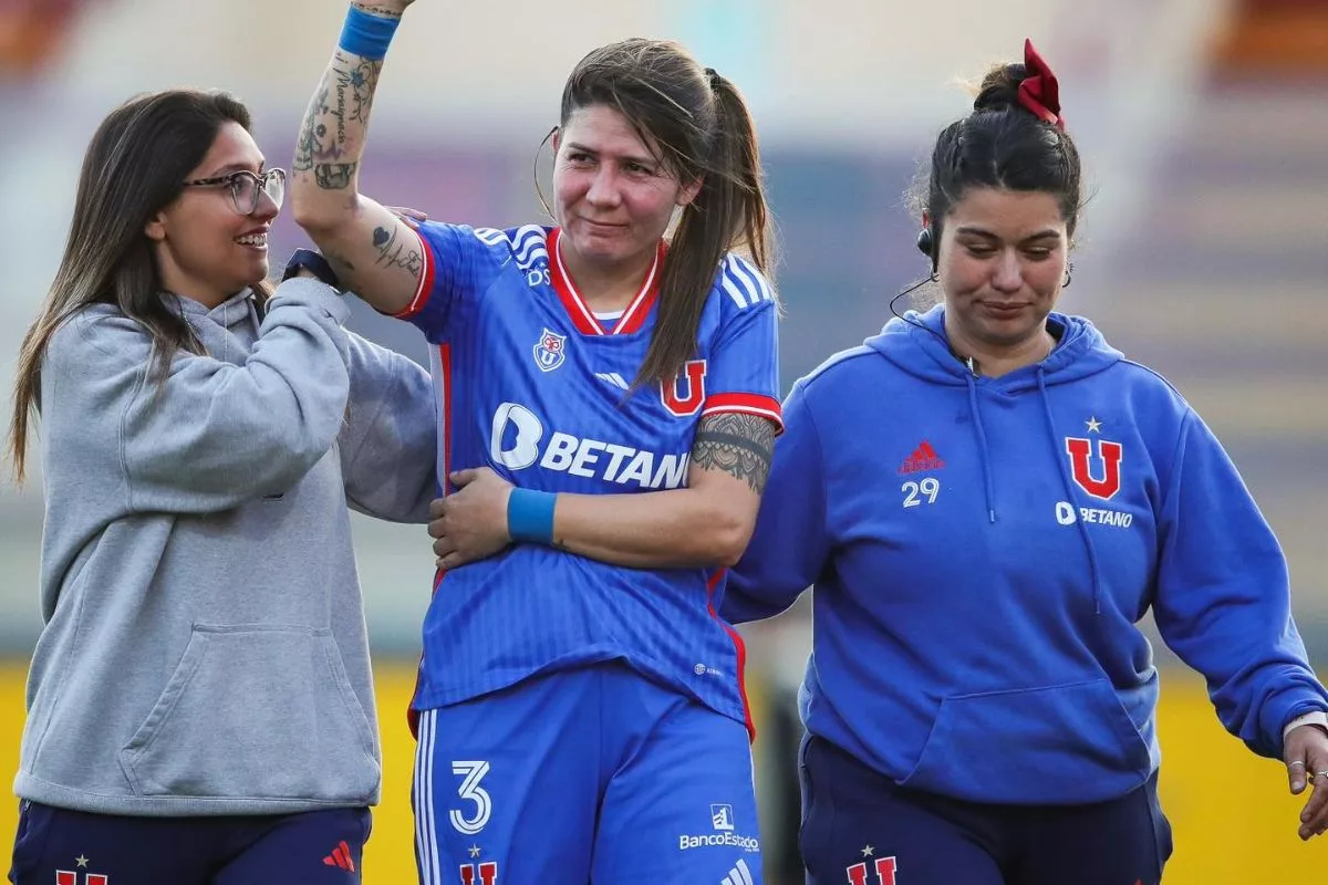 Doloroso: Así quedó el codo de Carla Guerrero tras su lesión en el Superclásico femenino